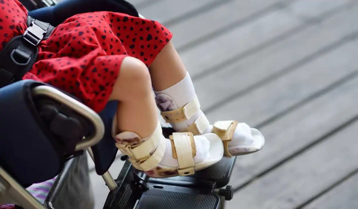 3 Best Wheelchairs for Broken Leg Recovery – Comfort and Mobility Guaranteed